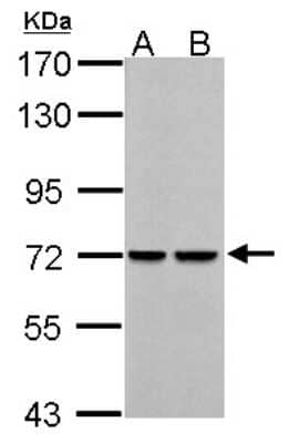Western Blot: PCK2 Antibody [NBP2-19729]