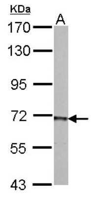 Western Blot: PCK2 Antibody [NBP2-19729]