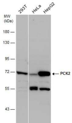 Western Blot: PCK2 Antibody [NBP2-19729]