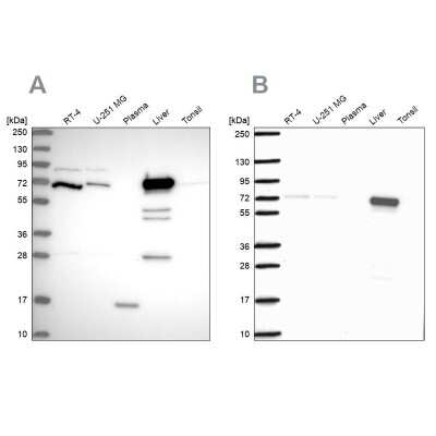 Western Blot: PCK2 Antibody [NBP2-33606]