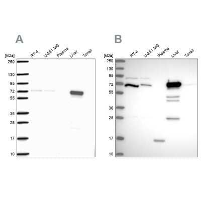 Western Blot: PCK2 Antibody [NBP2-33685]