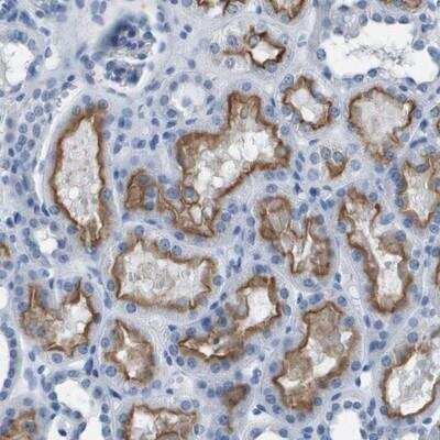 Immunohistochemistry: PCLKC Antibody [NBP1-92247]