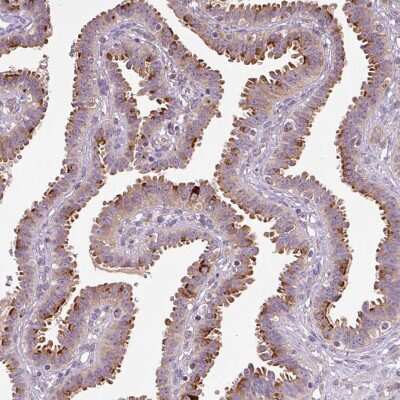 Immunohistochemistry-Paraffin: PCM1 Antibody (CL0206) [NBP2-52878]