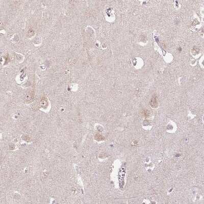 Immunohistochemistry-Paraffin: PCM1 Antibody (CL0206) [NBP2-52878]