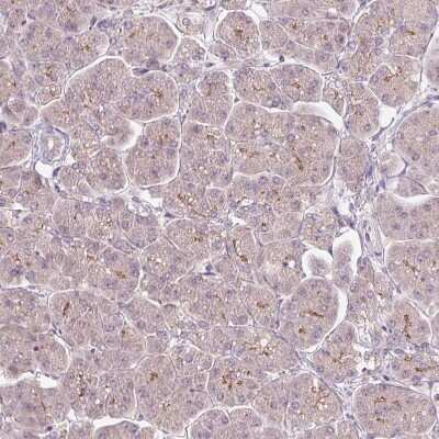 Immunohistochemistry-Paraffin: PCM1 Antibody (CL0206) [NBP2-52878]