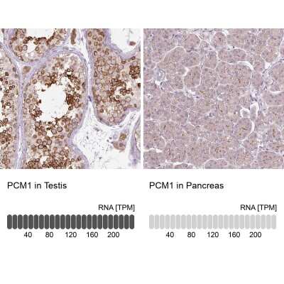 Immunohistochemistry-Paraffin: PCM1 Antibody (CL0206) [NBP2-52878]