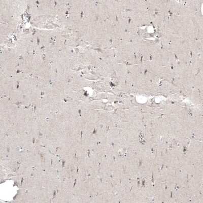 Immunohistochemistry-Paraffin: PCM1 Antibody [NBP1-87195]