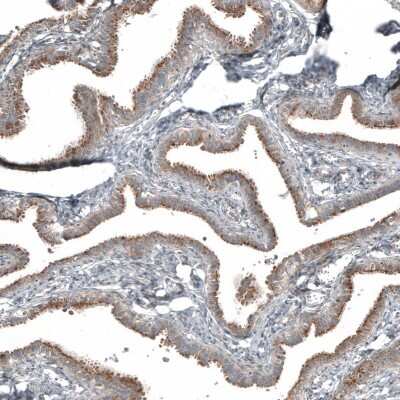 Immunohistochemistry-Paraffin: PCM1 Antibody [NBP1-87195]