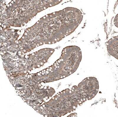 Immunohistochemistry-Paraffin: PCM1 Antibody [NBP1-87195]