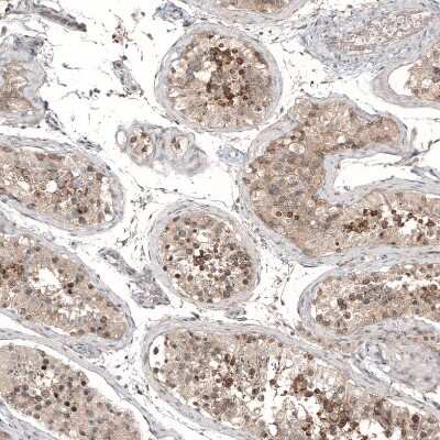 Immunohistochemistry-Paraffin: PCM1 Antibody [NBP1-87195]