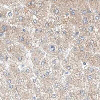 Immunohistochemistry-Paraffin: PCM1 Antibody [NBP1-87195]