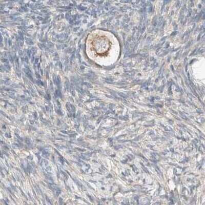 Immunohistochemistry-Paraffin: PCM1 Antibody [NBP1-87195]