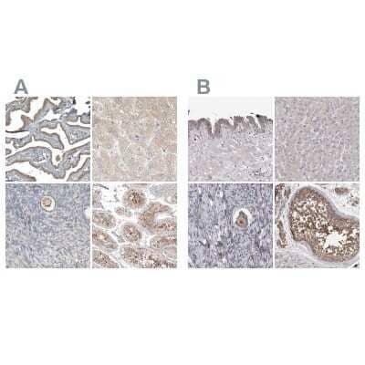 Immunohistochemistry-Paraffin: PCM1 Antibody [NBP1-87195]