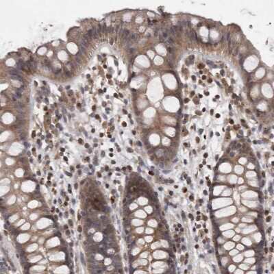 Immunohistochemistry-Paraffin: PCM1 Antibody [NBP1-87196]
