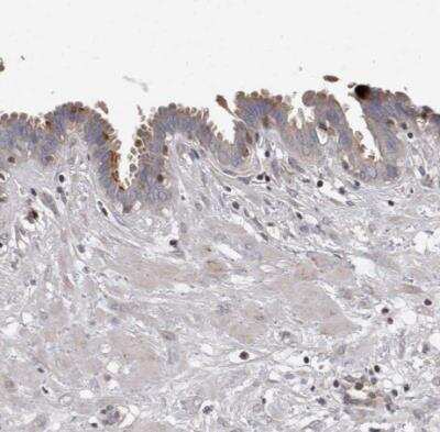 Immunohistochemistry-Paraffin: PCM1 Antibody [NBP1-87196]