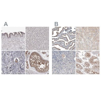 Immunohistochemistry-Paraffin: PCM1 Antibody [NBP1-87196]