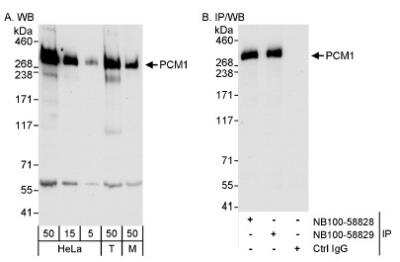 Western Blot: PCM1 Antibody [NB100-58828]
