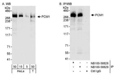 Western Blot: PCM1 Antibody [NB100-58829]