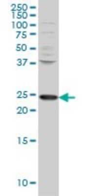 Western Blot: PCMT1 Antibody (1D6) [H00005110-M02]