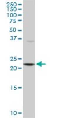 Western Blot: PCMT1 Antibody (1D6) [H00005110-M02]
