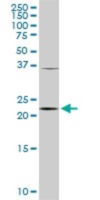 Western Blot: PCMT1 Antibody (1D6) [H00005110-M02]