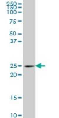 Western Blot: PCMT1 Antibody (4G9) [H00005110-M01]