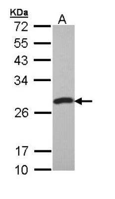 Western Blot: PCMT1 Antibody [NBP1-33019]