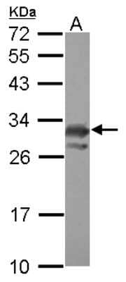 Western Blot: PCMT1 Antibody [NBP2-19731]