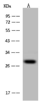 Western Blot: PCMT1 Antibody [NBP2-97711]