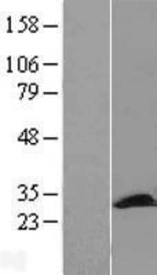 Western Blot: PCMT1 Overexpression Lysate [NBL1-14181]