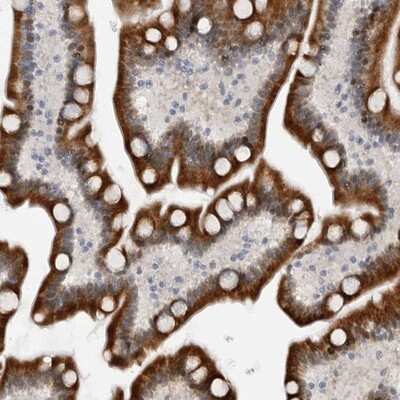 Immunohistochemistry-Paraffin: PCMTD1 Antibody [NBP1-83817]