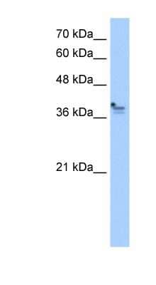 Western Blot: PCMTD1 Antibody [NBP1-54370]