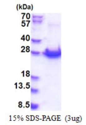 SDS-PAGE: Recombinant Human PCMTD1 His Protein [NBP2-23385]