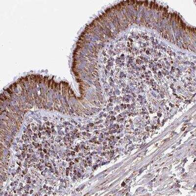 Immunohistochemistry-Paraffin: PCMTD2 Antibody [NBP2-31698]