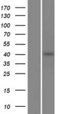 Western Blot: PCMTD2 Overexpression Lysate [NBP2-06840]