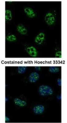 Immunocytochemistry/ Immunofluorescence: PCNA Antibody (339) [NB100-478]