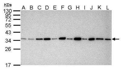 Western Blot: PCNA Antibody (339) [NB100-478]