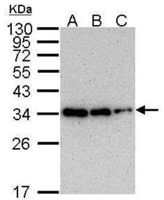 Western Blot: PCNA Antibody (339) [NB100-478]