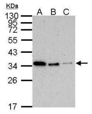 Western Blot: PCNA Antibody (339) [NB100-478]