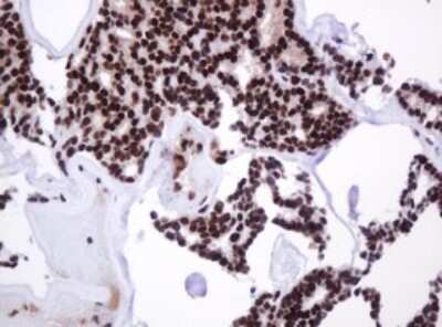 Immunohistochemistry: PCNA Antibody (OTI3D6) [NBP2-46342]