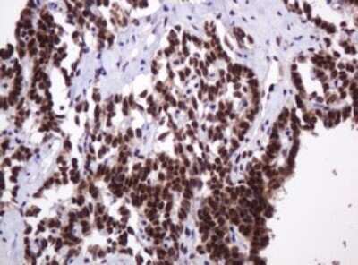 Immunohistochemistry: PCNA Antibody (OTI3D6) [NBP2-46342]