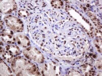 Immunohistochemistry: PCNA Antibody (OTI3D6) [NBP2-46342]