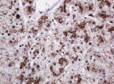 Immunohistochemistry: PCNA Antibody (OTI3D6) [NBP2-46342]