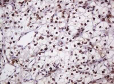 Immunohistochemistry: PCNA Antibody (OTI3D6) [NBP2-46342]