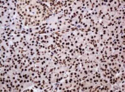 Immunohistochemistry: PCNA Antibody (OTI3D6) [NBP2-46342]