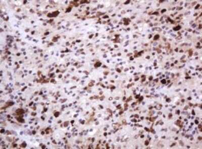 Immunohistochemistry: PCNA Antibody (OTI3D6) [NBP2-46342]