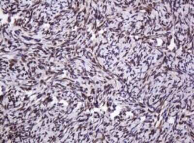 Immunohistochemistry: PCNA Antibody (OTI3D6) [NBP2-46342]