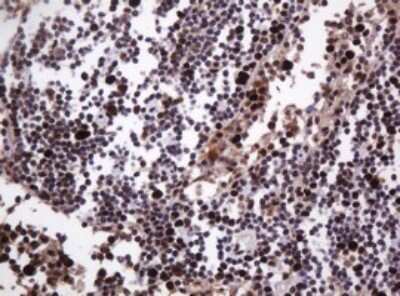 Immunohistochemistry: PCNA Antibody (OTI3D6) [NBP2-46342]