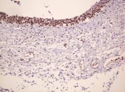 Immunohistochemistry: PCNA Antibody (OTI3D6) [NBP2-46342]