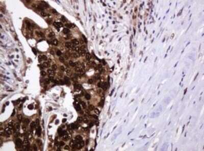 Immunohistochemistry: PCNA Antibody (OTI3D6) [NBP2-46342]